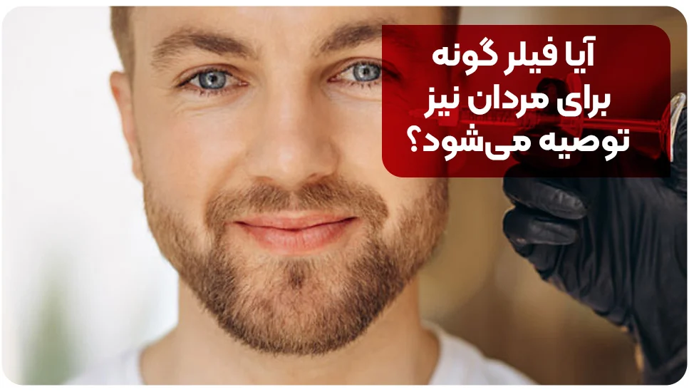 آیا فیلر گونه برای مردان نیز توصیه می‌شود؟