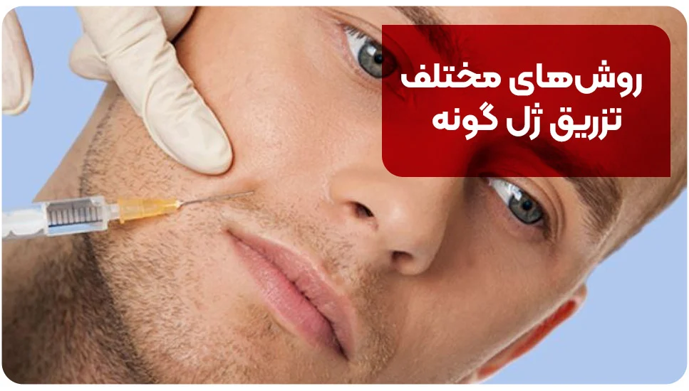 روش&zwnj;های مختلف تزریق ژل گونه