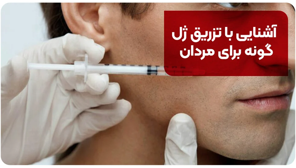 آشنایی با تزریق ژل گونه برای مردان