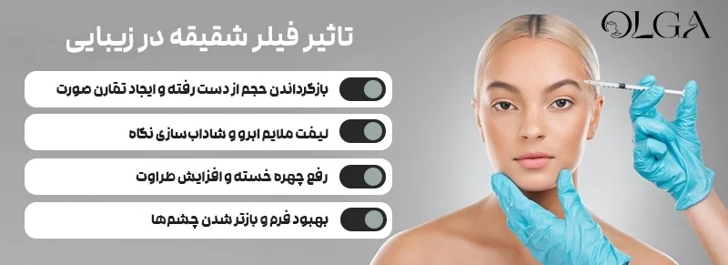 فیلر شقیقه